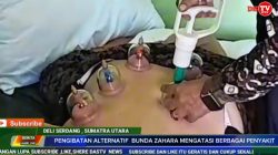 Pengobatan Alternatif Bekam Bunda Zahara, Solusi Terapi Alami untuk Berbagai Keluhan